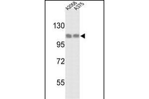 Western blot analysis of HSPH1 Antibody (C-term) (ABIN389381 and ABIN2839476) in  and  cell line lysates (35 μg/lane). (HSPH1 anticorps  (C-Term))