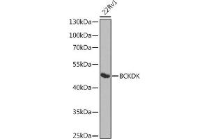 Western blot analysis of extracts of 22Rv1 cells, using BCKDK antibody (ABIN6127484, ABIN6137492, ABIN6137493 and ABIN6224210) at 1:1000 dilution. (BCKDK anticorps  (AA 153-412))