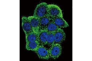 Immunofluorescence (IF) image for anti-Telomerase Reverse Transcriptase (TERT) (pTyr707) antibody (ABIN3001892)