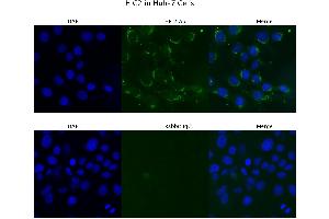 Sample Type :  Huh-7   Primary Antibody Dilution:  4 ug/ml   Secondary Antibody :  Anti-rabbit Alexa 546   Secondary Antibody Dilution:  2 ug/ml   Gene Name :  HIC2