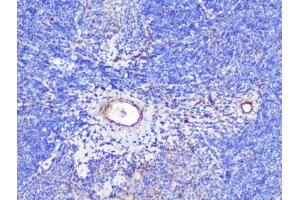 IHC analysis of INPPL1 using anti-INPPL1 antibody (ABIN6719492).