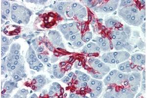 Human Pancreas (formalin-fixed, paraffin-embedded) stained with KRT19 antibody ABIN396943 at 10 ug/ml followed by biotinylated anti-mouse IgG secondary antibody ABIN481714, alkaline phosphatase-streptavidin and chromogen. (Cytokeratin 19 anticorps)