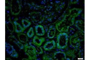 Paraformaldehyde-fixed, paraffin embedded human kidney, Antigen retrieval by boiling in sodium citrate buffer (pH6) for 15min, Block endogenous peroxidase by 3% hydrogen peroxide for 20 minutes, Blocking buffer (normal goat serum) at 37°C for 30min, Antibody incubation with IL-1R2 Polyclonal Antibody, Unconjugated  at 1:200 overnight at 4°C, followed by a conjugated secondary -FITC) at [1:500] for 90 minutes and DAPI staining of the nuclei.