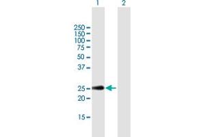 Western Blot analysis of CLEC2D expression in transfected 293T cell line by CLEC2D MaxPab polyclonal antibody. (CLEC2D anticorps  (AA 1-191))