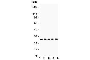 Western blot testing of ERAB antibody and Lane 1:  mouse lung