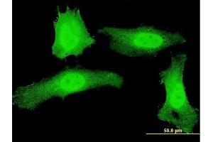 Immunofluorescence of monoclonal antibody to PLEKHG5 on HeLa cell.