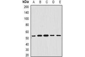 Western blot analysis of BAR expression in A549 (A), SHSY5Y (B), mouse brain (C), mouse liver (D), rat heart (E) whole cell lysates. (BFAR anticorps)