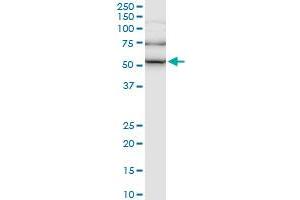 ILK monoclonal antibody (M01), clone 4F10. (ILK anticorps  (AA 341-452))