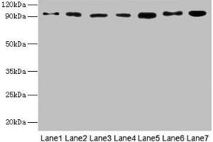 Western blot All lanes: USP5 antibody at 10 μg/mL Lane 1: Mouse brain tissue Lane 2: A549 whole cell lysate Lane 3: MCF-7 whole cell lysate Lane 4: A375 whole cell lysate Lane 5: U251 whole cell lysate Secondary Goat polyclonal to rabbit IgG at 1/10000 dilution Predicted band size: 96, 94 kDa Observed band size: 96 kDa (USP5 anticorps  (C-Term))