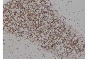 ABIN6277232 at 1/100 staining Rat brain tissue by IHC-P.