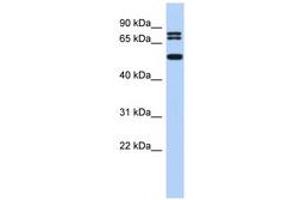 Image no. 1 for anti-Ceramide Synthase 4 (CERS4) (N-Term) antibody (ABIN6742880) (LASS4 anticorps  (N-Term))
