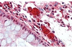 Detection of HEXb in Human Colon Tissue using Polyclonal Antibody to Hexosaminidase B Beta (HEXb) (HEXB anticorps  (AA 315-456))