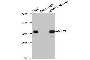 Immunoprecipitation analysis of 200ug extracts of 293T cells using 1ug MNAT1 antibody. (MNAT1 anticorps)