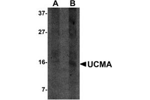 Western Blotting (WB) image for anti-Upper Zone of Growth Plate and Cartilage Matrix Associated (UCMA) (C-Term) antibody (ABIN1030790) (UCMA anticorps  (C-Term))