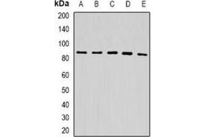 Western blot analysis of USP10 expression in HepG2 (A), A549 (B), mouse liver (C), mouse kidney (D), rat brain (E) whole cell lysates. (USP10 anticorps)