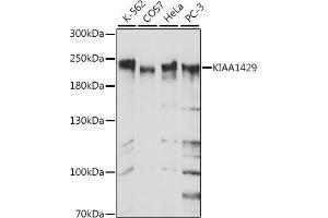 Western blot analysis of extracts of Mouse lung, using KI antibody (ABIN7269712) at 1:2080 dilution. (Protein Virilizer Homolog (VIRMA) (AA 1400-1700) anticorps)