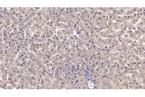 Detection of ANXA3 in Human Liver Tissue using Monoclonal Antibody to Annexin A3 (ANXA3) (Annexin A3 anticorps  (AA 190-312))