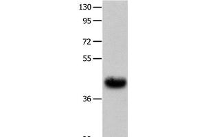 Western Blot analysis of Human fetal muscle tissue using UTS2R Polyclonal Antibody at dilution of 1:400
