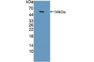 Detection of Recombinant USP7, Human using Polyclonal Antibody to Ubiquitin Specific Peptidase 7 (USP7) (USP7 anticorps  (AA 54-507))