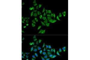 Immunofluorescence analysis of HeLa cells using DOK1 Polyclonal Antibody