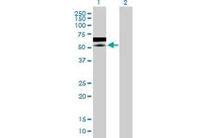 Western Blot analysis of ZNF358 expression in transfected 293T cell line by ZNF358 MaxPab polyclonal antibody. (ZNF358 anticorps  (AA 1-481))