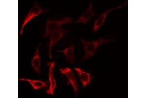 ABIN6275177 staining COLO205  cells by IF/ICC. (GNAT1 anticorps  (Internal Region))