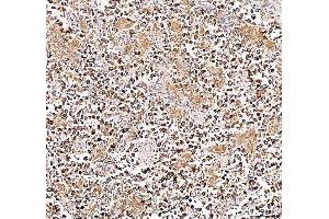 IHC analysis of DYNLT1 using anti-DYNLT1 antibody (ABIN5693148).