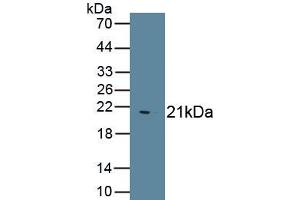 Detection of Recombinant IHH, Human using Polyclonal Antibody to Hedgehog Homolog, Indian (IHH)
