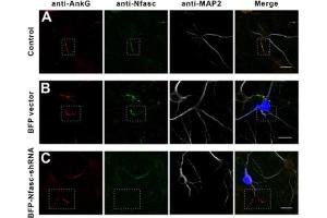 Immunostaining of mouse WT neurons (A) or neurons transfected with BFP vector (B), or BFP-Nfasc-shRNA (C) and stained for AnkG (red), Nfasc (green), and MAP2 (white). (Ankyrin G anticorps)