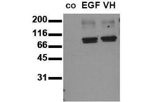 Western Blotting (WB) image for anti-Signal Transducer and Activator of Transcription 3 (Acute-Phase Response Factor) (STAT3) (pTyr705) antibody (ABIN126898) (STAT3 anticorps  (pTyr705))
