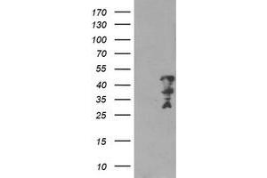 Western Blotting (WB) image for anti-Myeloid Leukemia Factor 2 (MLF2) antibody (ABIN1499501) (MLF2 anticorps)