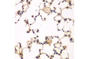 Immunohistochemistry of paraffin-embedded rat lung using NFKBIB antibody (ABIN6130475, ABIN6144584, ABIN6144585 and ABIN6221459) at dilution of 1:200 (40x lens). (NFKBIB anticorps  (AA 1-356))