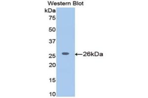 Western Blotting (WB) image for anti-Meningioma Expressed Antigen 5 (Hyaluronidase) (MGEA5) (AA 19-222) antibody (ABIN1172151) (MGEA5 anticorps  (AA 19-222))