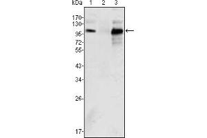 Western blot analysis using Androgen receptor mouse mAb against K562 (1), Jurkat (2) and LNCaP (3) cell lysate. (Androgen Receptor anticorps)