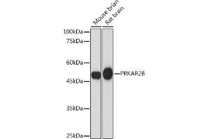 Western blot analysis of extracts of various cell lines, using PRKB Rabbit mAb (ABIN7269663) at 1:1000 dilution. (PRKAR2B anticorps)