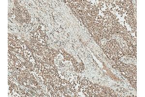 Immunohistochemistry analysis using Rabbit Anti-IGF-1 Polyclonal Antibody (ABIN5066653).