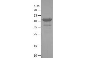 Western Blotting (WB) image for Progesterone Immunomodulatory Binding Factor 1 (PIBF1) (AA 563-757) protein (His-IF2DI Tag) (ABIN7124572) (PIBF1 Protein (AA 563-757) (His-IF2DI Tag))