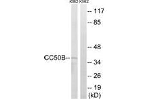 Western blot analysis of extracts from K562 cells, using TMEM30B Antibody.