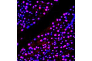Immunofluorescence of paraffin embedded mouse pancreas using TFIIIC110 (ABIN7074038) at dilution of 1:650 (400x lens)