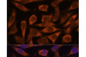 Immunofluorescence analysis of L929 cells using ME3 Polyclonal Antibody at dilution of 1:100. (ME3 anticorps)