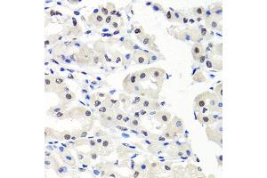 Immunohistochemistry of paraffin-embedded human stomach using CBX1 antibody (ABIN5971253) at dilution of 1/100 (40x lens). (CBX1 anticorps)