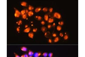 Immunofluorescence analysis of HeLa cells using EPB41L2 Polyclonal Antibody at dilution of 1:100. (EPB41L2 anticorps)