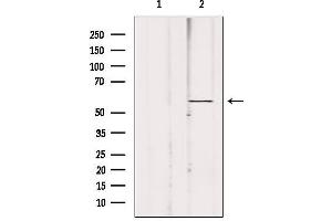 Western blot analysis of extracts from 293, using ACBD5 Antibody.