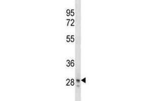 SNAI3 antibody western blot analysis in T47D lysate. (SNAI3 anticorps  (AA 1-29))