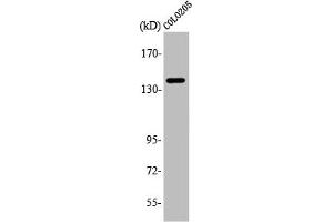 Western Blot analysis of COLO205 cells using A Cyclase V/VI Polyclonal Antibody (ADCY6 anticorps  (C-Term))