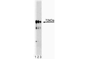 Western blot analysis of LIMK1 on rat cerebellum lysate. (LIM Domain Kinase 1 anticorps  (AA 232-333))