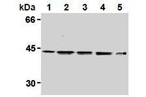 Western Blotting (WB) image for anti-Mitogen-Activated Protein Kinase Kinase 1 (MAP2K1) antibody (ABIN1108123) (MEK1 anticorps)