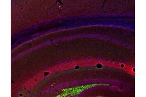 Indirect immunostaining of PFA fixed mouse hippocampus section with anti-HCN 1 (dilution 1 : 200; red) and guinea pig anti-ZnT 3 (cat.
