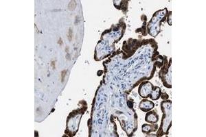 Immunohistochemical staining of human placenta with BPGM polyclonal antibody  shows strong cytoplasmic positivity in trophoblastic cells at 1:50-1:200 dilution.