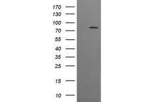 Image no. 1 for anti-Dynamin 1-Like (DNM1L) antibody (ABIN1497871)